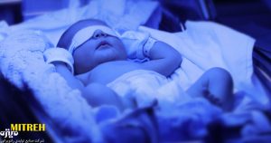 لامپ برای زردی بچه ؛ خطرهای لامپ کم مصرف برای نوزاد